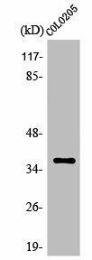 OR52E5 Antibody (PACO01243)