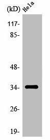 OR6T1 Antibody (PACO01257)