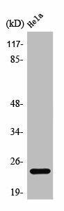 PPP1R14D Antibody (PACO01358)