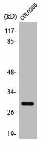 RAB6C Antibody (PACO01385)