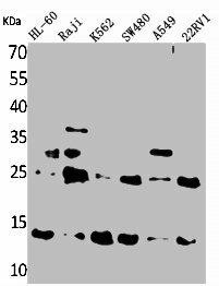 TXNDC17 Antibody (PACO01845)