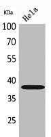 KIR2DL3/KIR2DS2 Antibody (PACO02093)