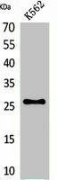 FGF16 Antibody (PACO02117)