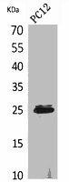 CMTM5 Antibody (PACO02160)