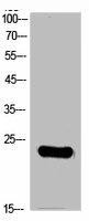 RGS1 Antibody (PACO02224)