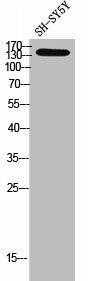 PNPLA6 Antibody (PACO02379)