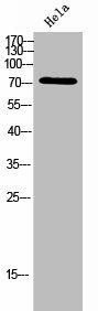 SLC27A5 Antibody (PACO02384)