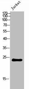 CYB561D2 Antibody (PACO02390)