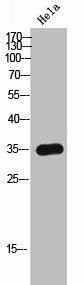 OR8I2 Antibody (PACO02445)