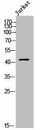 OR2AJ1 Antibody (PACO02470)