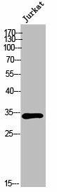 OR6P1 Antibody (PACO02472)