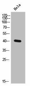 ELAVL2/ELAVL4 Antibody (PACO02632)