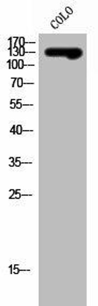SLC4A8/SLC4A10 Antibody (PACO03035)