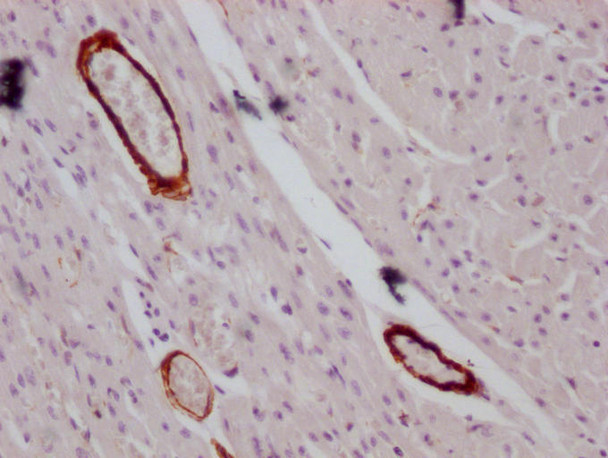 Anti-ACTA2/ACTG2 Antibody (MACO0472)