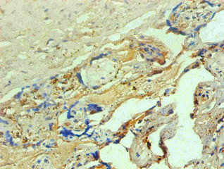 Anti-Hemoglobin Antibody (MACO0533)
