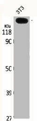 COL5A3 Antibody (PACO06368)