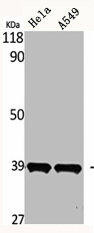 MTNR1B Antibody (PACO06633)