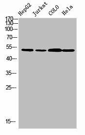 TRMT11 Antibody (PACO07209)