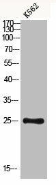 CLEC6A Antibody (PACO07212)