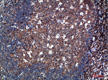 TPSD1 Antibody (PACO07265)