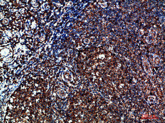 CYFIP2 Antibody (PACO07269)