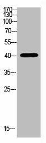 HLA-A Antibody (PACO07298)