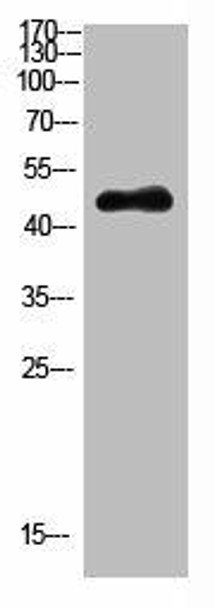 KRT14/KRT17 Antibody (PACO07457)