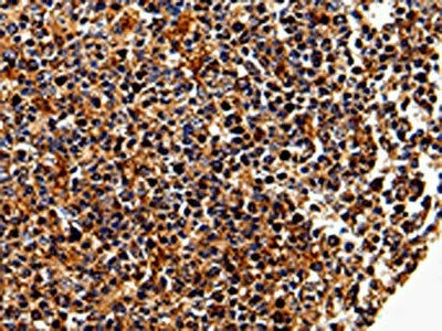 IL17RC Antibody (PACO13976)