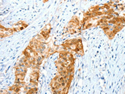 ANXA8 Antibody (PACO14043)