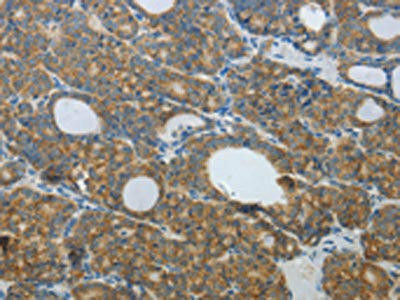 DNAJC3 Antibody (PACO14816)