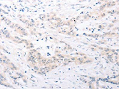 SPATA16 Antibody (PACO15162)