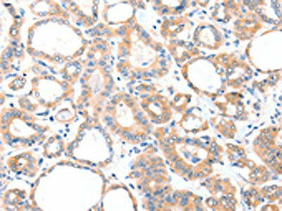 AADACL2 Antibody (PACO15216)