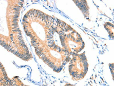 ACSM5 Antibody (PACO15272)