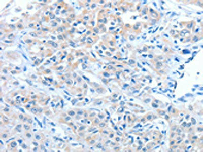 ADAM7 Antibody (PACO15309)