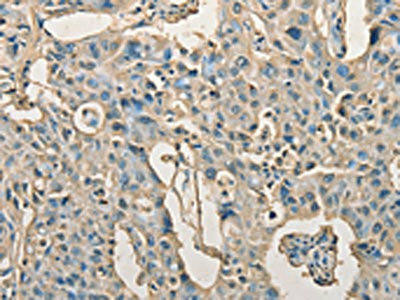 AGBL2 Antibody (PACO15342)