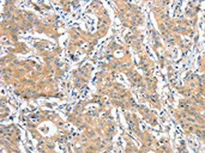 ANKMY2 Antibody (PACO15444)