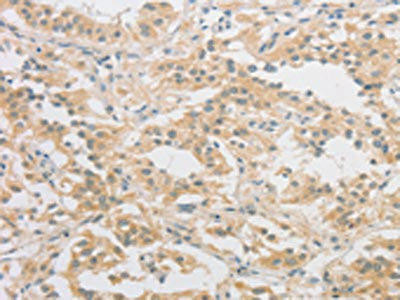 HIPK4 Antibody (PACO15650)