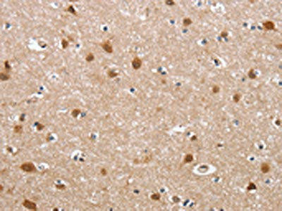 DEFA6 Antibody (PACO15816)