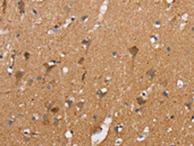 CASC3 Antibody (PACO15935)