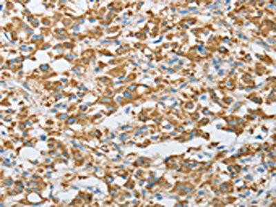 CENPO Antibody (PACO16006)
