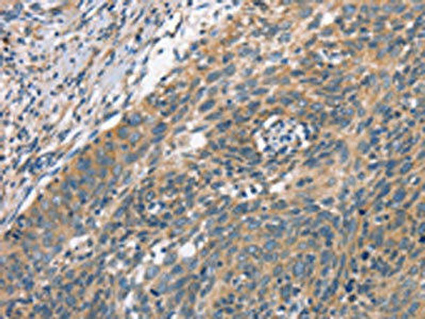 PLEKHO1 Antibody (PACO16038)