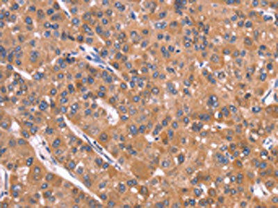 CRISP3 Antibody (PACO16075)