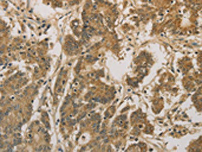 CXXC5 Antibody (PACO16093)