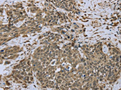 DCTN4 Antibody (PACO16156)
