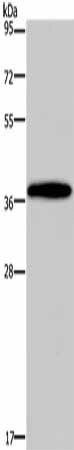 DLX4 Antibody (PACO16191)