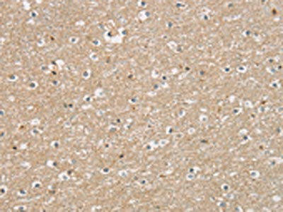 DMRT3 Antibody (PACO16192)