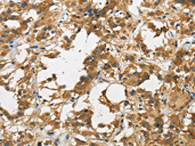 DUSP23 Antibody (PACO16209)