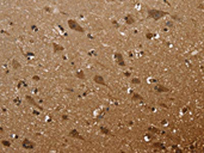 FANCF Antibody (PACO16309)