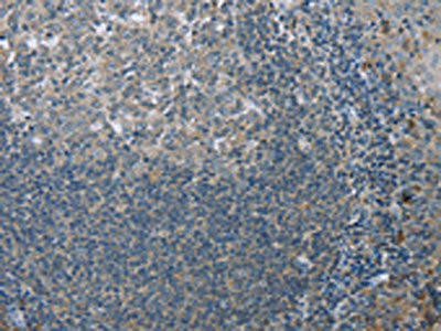 FAR2 Antibody (PACO16314)