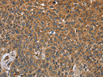 GH2 Antibody (PACO16411)